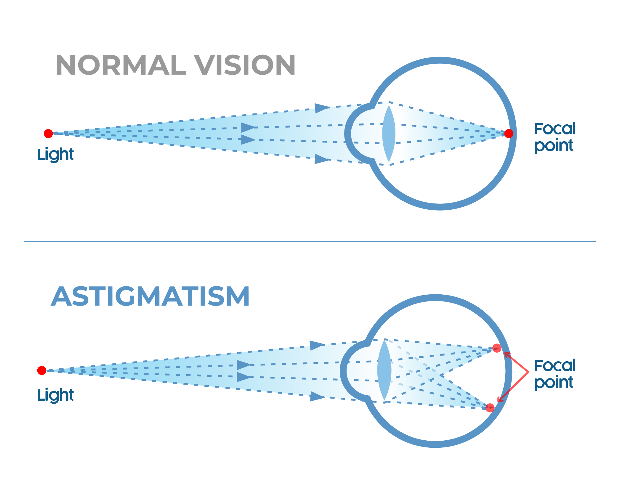 Can I Get High Prescription Color Contacts for Astigmatism?